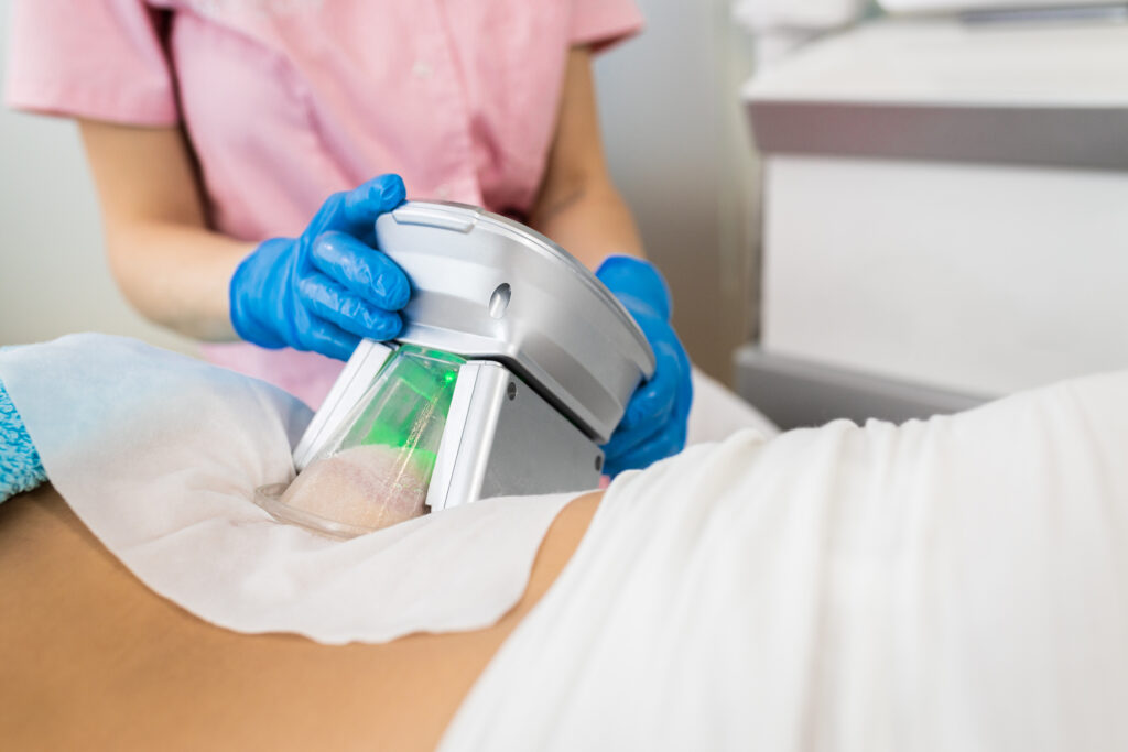 Fat freezing treatment in Juhu